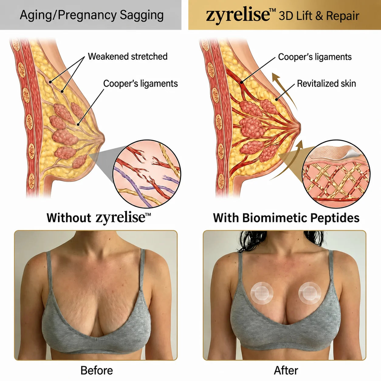 🔥Limited-time 80% sale--Zyrelise™ Targeted Breast Enhancement Advanced Nano-Microneedle Patches