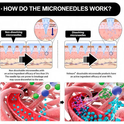 Zyrelise™ Advanced Microneedle Wellness Patch