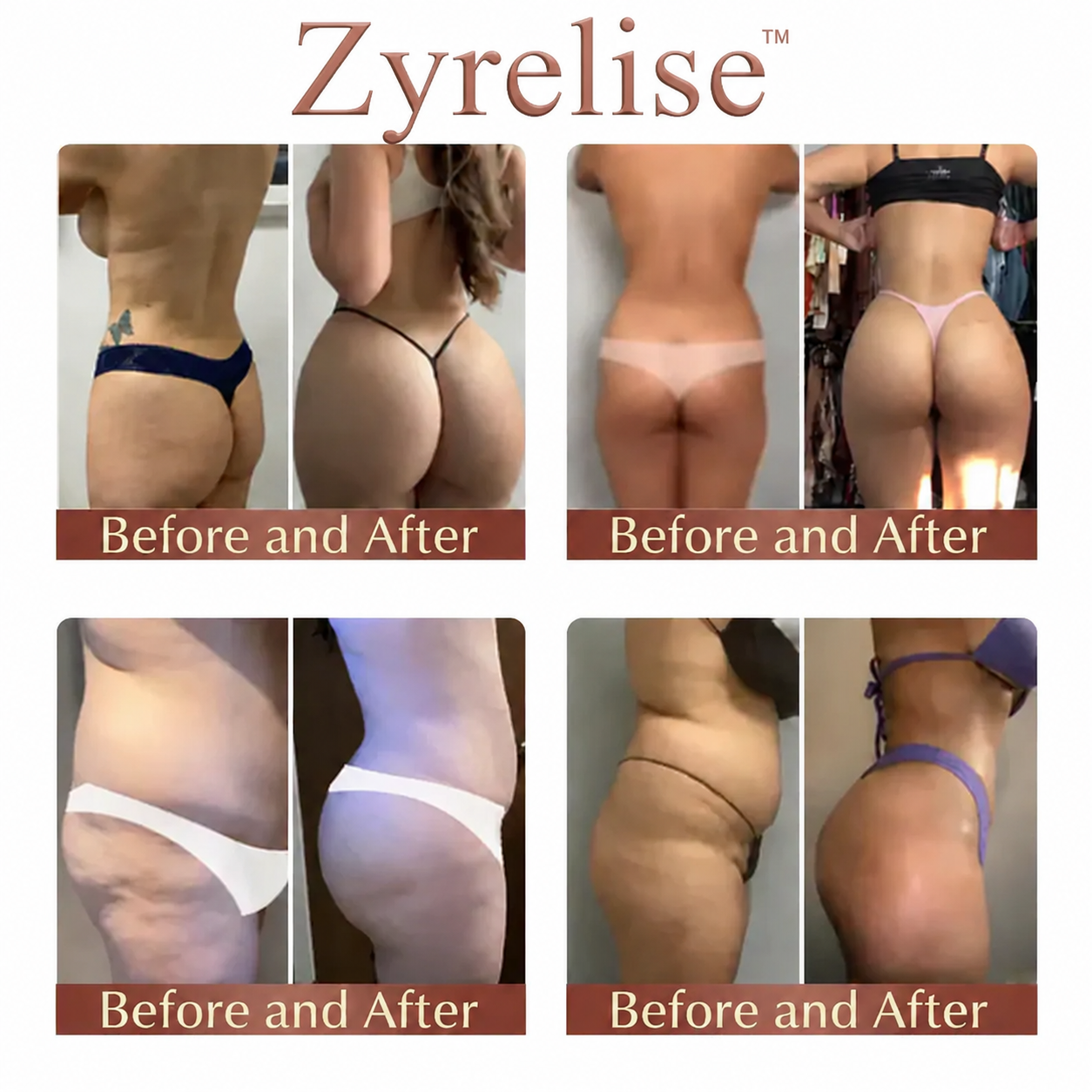 Zyrelise™ CurveSculpt Micro-Patch ✦ Sculpt • Firm • Smooth Lower Body Curves ✦ Micro-Needle Infusion System