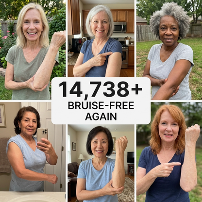 💥100K+ SOLD💕- Zyrelise™ Bruise Repair & Skin-Strengthening Cream